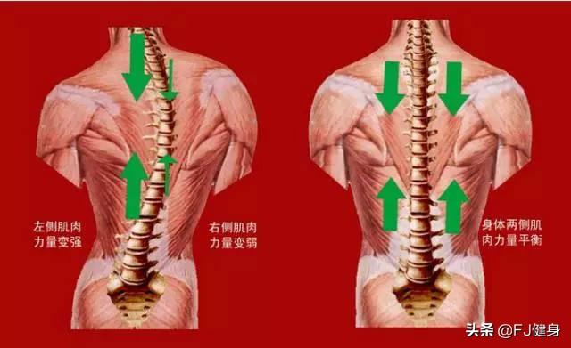 背部右侧肌肉比左部大;背部右侧一条肌肉肿起