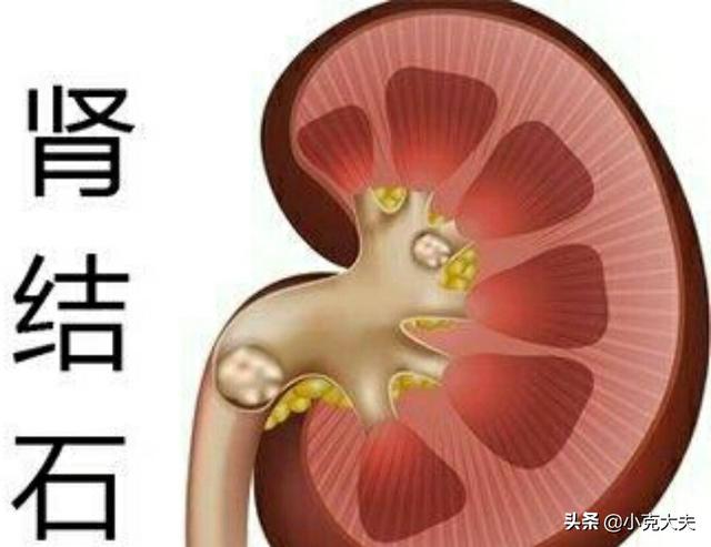 腰中间部分酸胀是什么原因女性-女性腰中间酸胀是什么原因