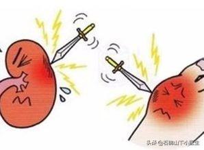 尿酸过高是尿毒症前兆吗:尿酸高的人身体出现哪些变化说明已经得了痛风肾？