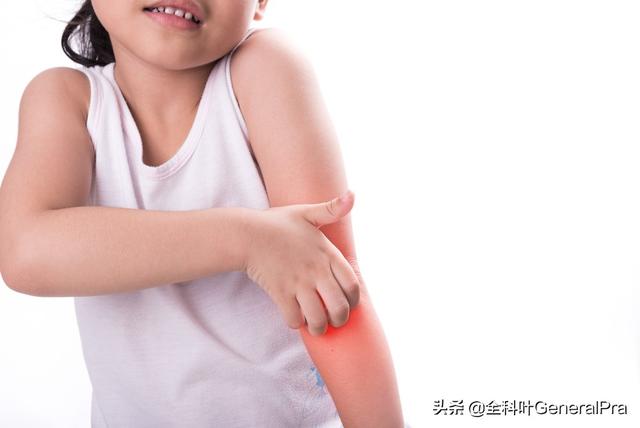 头条问答 为什么有时跳绳后身上会发痒 用户的回答 0赞