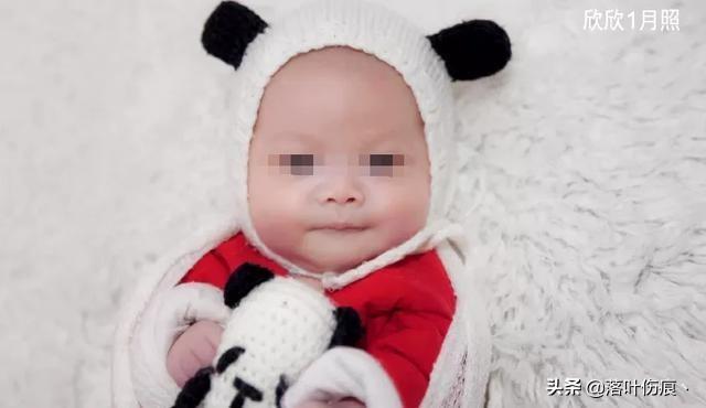 不明生物图片吓人，女婴睡觉时头皮被啃漏出头骨，原因是什么呢？