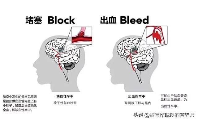 如何识别脑梗的先兆表现，脑梗不是悄无声息的，头部出现哪些表现，表明脑梗要来临了