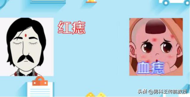 头条问答 身上有小红痣 千万别大意 是大病的预警信号吗 中医王传航主任的回答 0赞