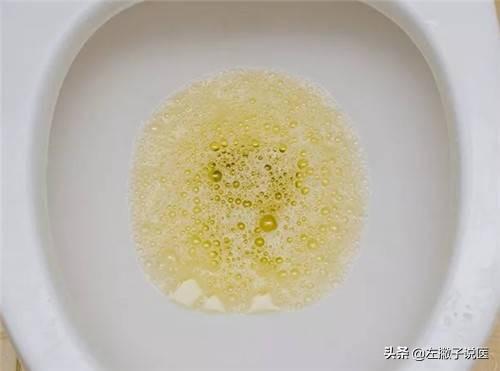 萌狗俊介尿液有泡沫:宠物养护俊介流鼻涕拉稀怎么办 小便中带泡沫是泌尿系统出了什么问题？