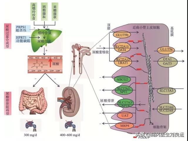黄精蝮蛇丸:什么食物能溶解尿酸结晶？