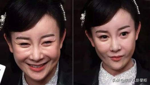 李颖芝整容前:张檬以前有多好看？为何后来要去整容？