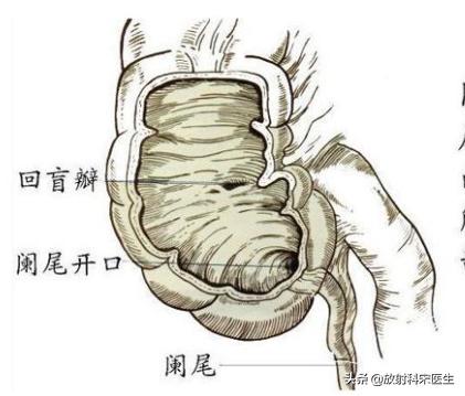 断脉，断脉是什么意思