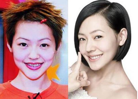 贾青整容:整容最成功的女明星是谁？