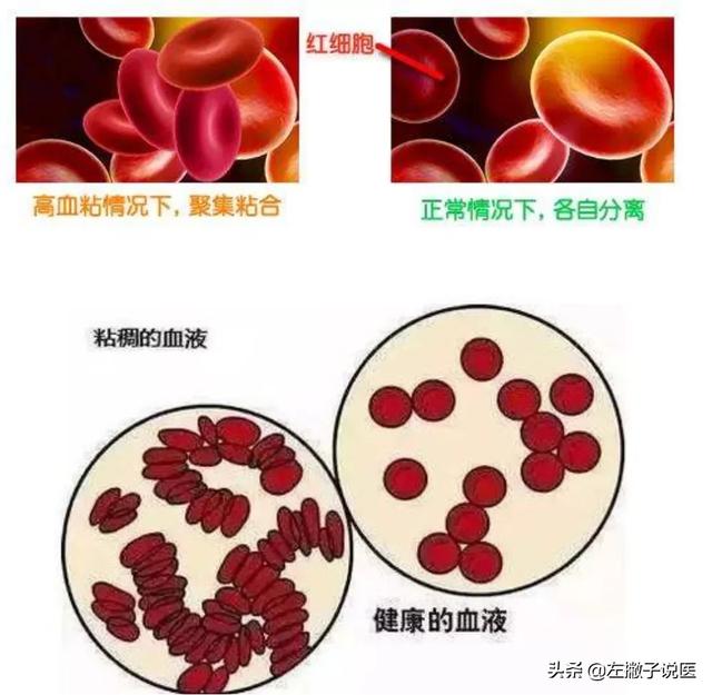 头条问答 - 血粘稠一般都有怎样的身体变化?(90个回答)