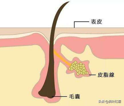 怎么疏通毛孔(怎么疏通毛孔排出黑色素)