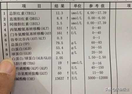 怎么检查肝功能：怎么检查肝功能是否正常