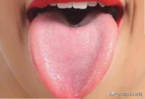 为什么总犯口舌，吃什么东西舌头都不舒服，口腔科看了教授、专家，说没问题，求解