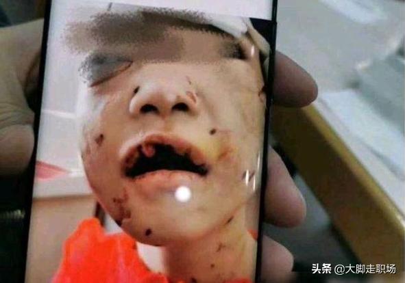 果然,被虐待进ICU的4岁女孩还没苏醒,继母就被曝出患有精神病！如何评价？