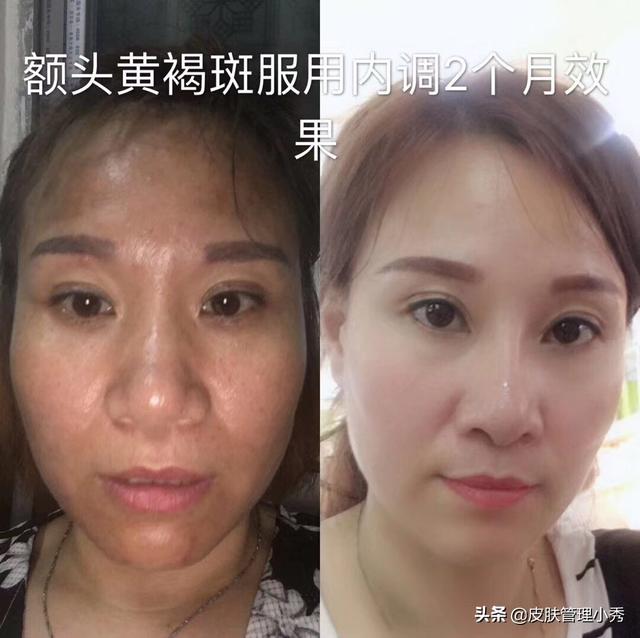 什么面霜可以美白去黄保湿？