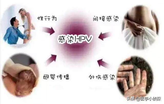 疣状表皮发育不良:女子打过hpv疫苗，6年后却查出宫颈癌，疫苗不管用吗，为何？