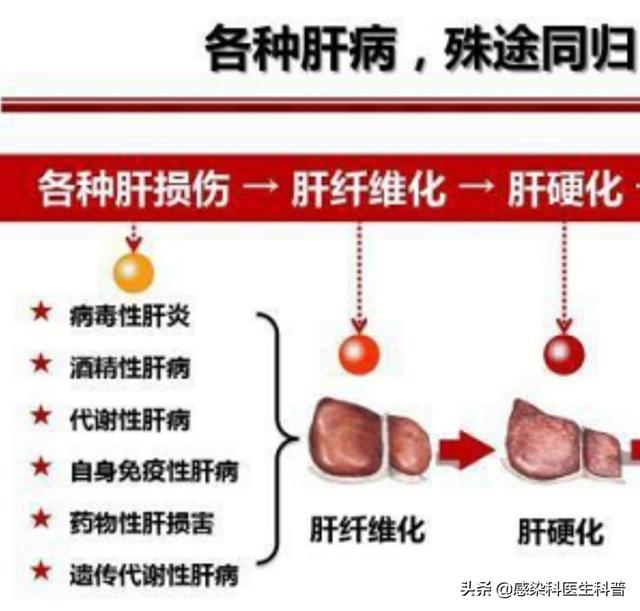 晚期糖尿病有什么症状:晚期糖尿病有什么症状表现 肝硬化严重身体会有什么症状吗？