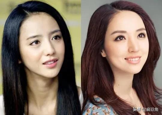 秦岚整容:娱乐圈里的哪些演员让你傻傻分不清？