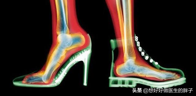 膝盖软骨磨损和风湿什么区别:不跑步的人膝关节也磨损、坏死，该怎么解释呢？
