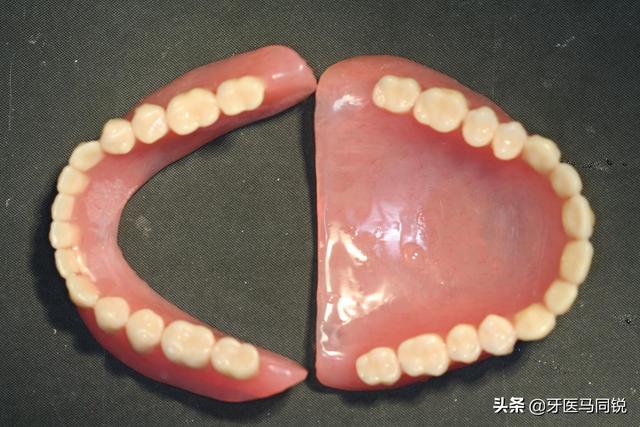 装全口假牙不掉吗？怎么才不会掉？
