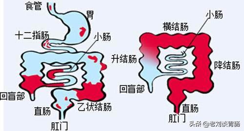 老拉肚子怎么回事:老拉肚子是什么原因引起的怎么办 经常拉肚子有什么需要注意的么？