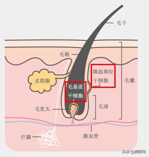 如何永久脱毛(如何永久脱毛)