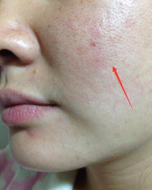 生活中还有比蚊子更让人痛恨的昆虫吗？