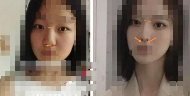 fx组合郑水晶整容:项思醒的整容做下来要多少钱？