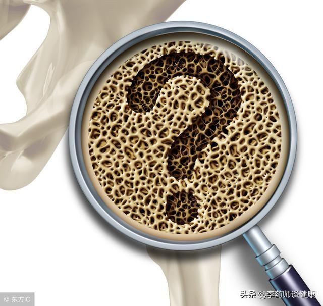 补钙就能预防骨质疏松吗，预防骨质疏松，补充钙就可以了吗？