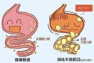 乳糖不耐受宝宝最常见的症状有哪些？插图36