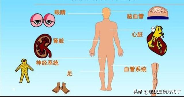 晚期糖尿病有什么症状:糖尿病晚期有些什么症状 提示糖尿病加重的危险信号有哪些？