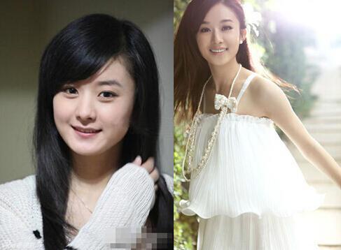 贾青整容:整容最成功的女明星是谁？