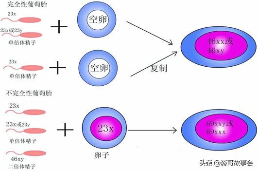 葡萄胎是怎么形成的:葡萄胎是怎么回事，葡萄胎的特征