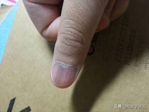 生活中有哪些养肝护肝的方法？