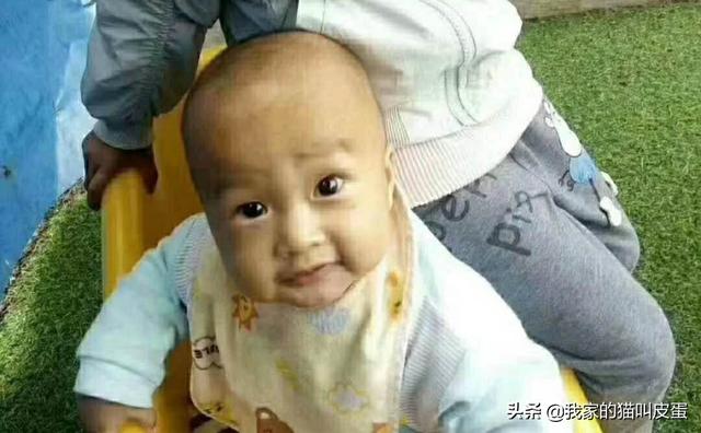 男童挖眼案:丽江永胜被偷男童自案发之时起已39个小时过去，现在情况怎么样
