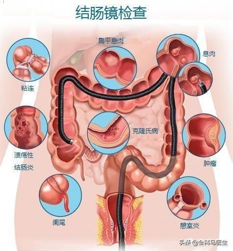 日屁对人有什么好处,人为什么放屁，总放屁正常吗？