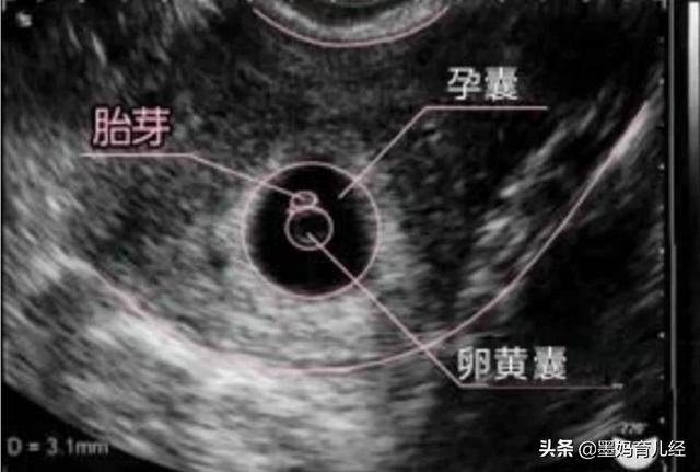 验孕棒如何判断是否怀孕:验孕棒怎么判断怀孕 不用验孕棒如何能知道自己是不是怀孕了？