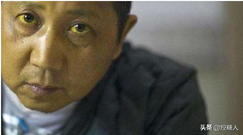 业障重女人的表现,女人肝不好，身体会有哪些表现？如何调养？