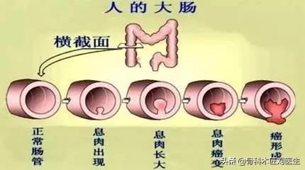 便血怎么治疗;便血怎么治疗比较好