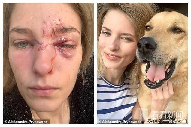 美女与狗狗壁纸高清:女模被领养的狗咬毁容险失明，指责收养所反被骂，你怎么看？