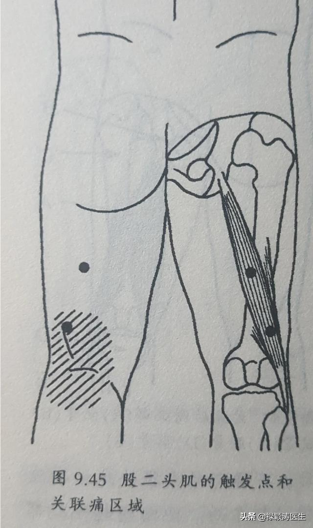 头条问答 - 天气一冷,左腿大腿后面的一根筋坐下就胀疼,站起来不疼了