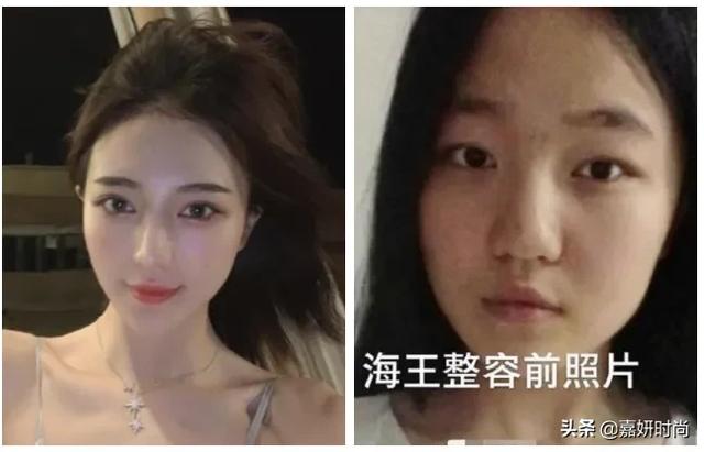 李毓芬整容前:女海王项思醒整容前算美女么？