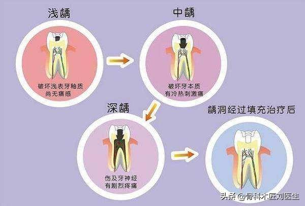 口臭“天敌”找到了,经常喝一点,清新口气,吓跑幽门螺杆菌！口臭的天敌是什么？