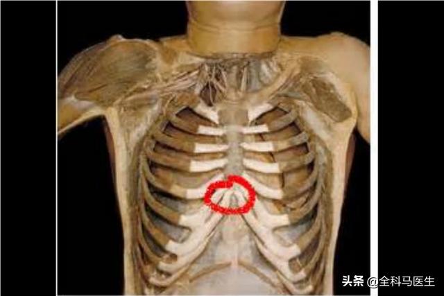 头条问答 - 心窝正中痛是怎么回事?(79个回答)