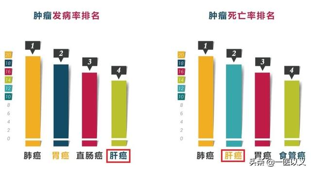 头条问答 肝癌的扩散速度有多快 216个回答