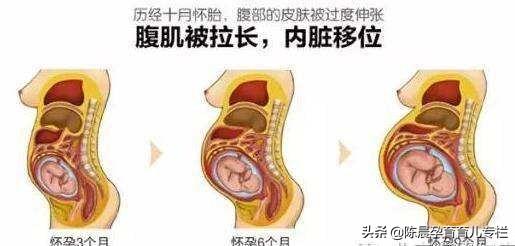 怀孕到了12周,子宫逐步增大,子宫的开端压迫到膀胱和直肠,使得膀胱
