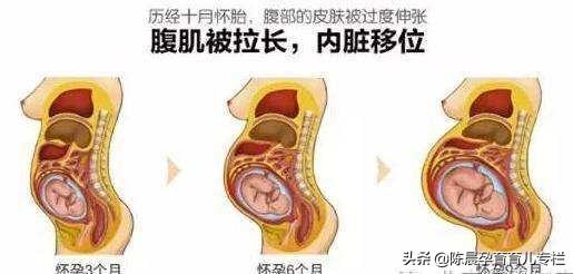 怀孕后子宫压迫膀胱图图片