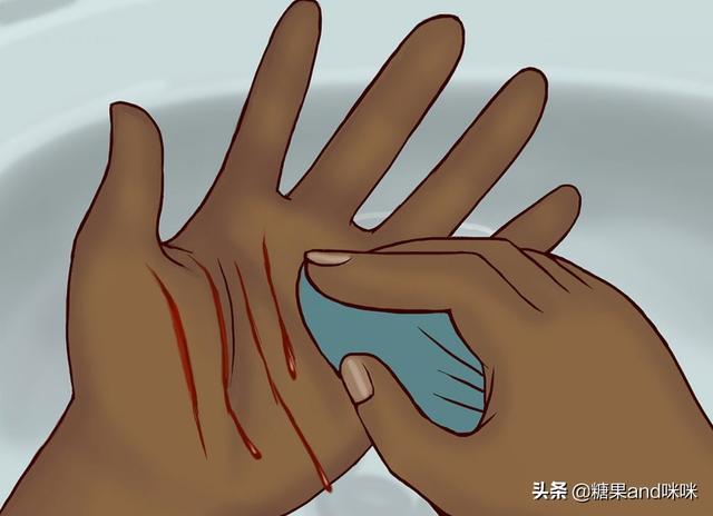 猫白血病:被三个月大打过一针疫苗的猫咪划伤，需要去打狂犬疫苗吗？