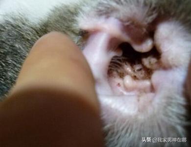 螨虫怎么治疗:医院是怎样除人体螨虫的？
