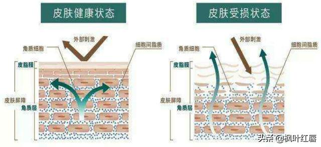 皮肤卡粉浮粉怎么改善，怎么解决秋冬皮肤干燥卡粉、浮粉等问题