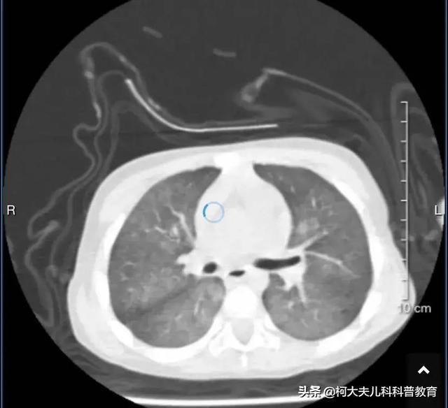 病毒检查查什么，病毒7项检查查什么